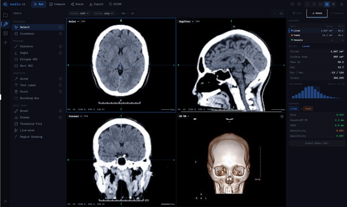 Medio 3D — 의료영상 2D/3D 뷰어